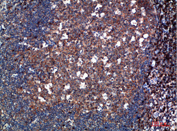 TPSD1 Antibody
