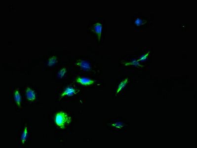 TPTE Antibody