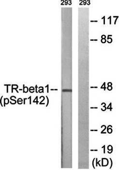 TR-β1 (Phospho-Ser142) Antibody