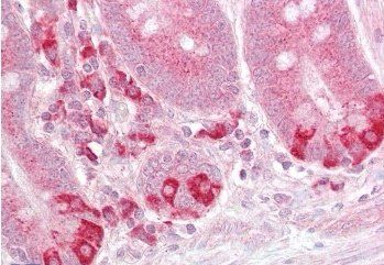 TRAF1 Antibody