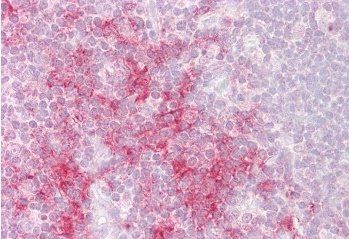TRAF1 Antibody