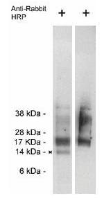 Rabbit anti Human Trag 3 (Taxol-resistant-associated protein 3)