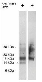 Rabbit anti human Trag 3 (Taxol-resistant-associated protein 3)