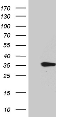 TRAIL Antibody