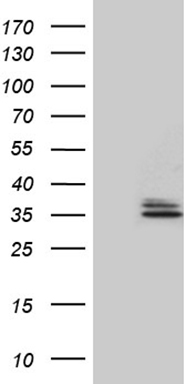 TRAIL Antibody