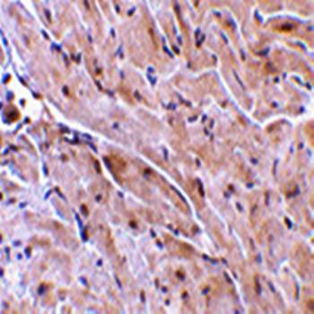 TRIAD3A Antibody