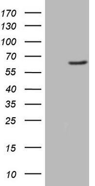 TRIB3 Antibody