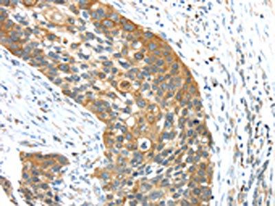 TRIM16 Antibody