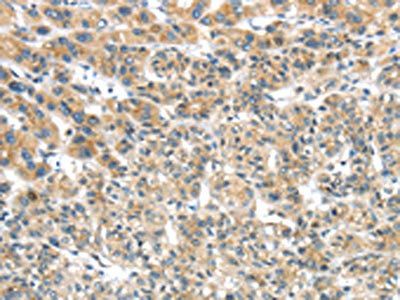 TRIM16 Antibody