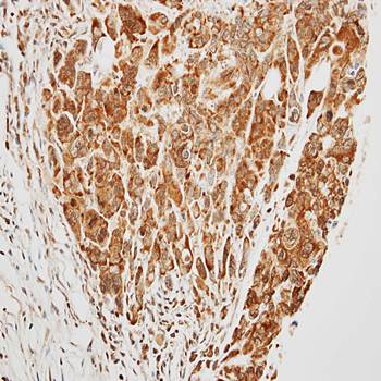 TRIM37 antibody