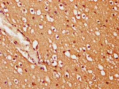 TRIM45 Antibody