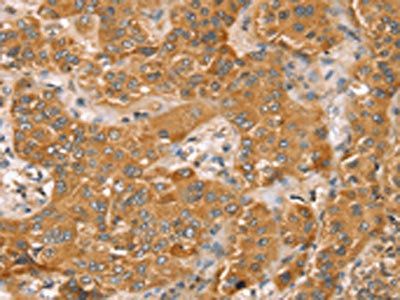 TRIM45 Antibody