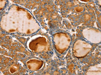 TRIM45 Antibody