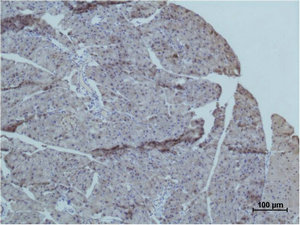 TRIM72 Antibody