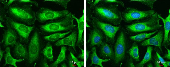 Triosephosphate isomerase antibody [C2C3], C-term