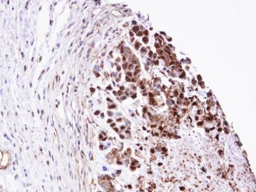 Triosephosphate isomerase antibody [C2C3], C-term