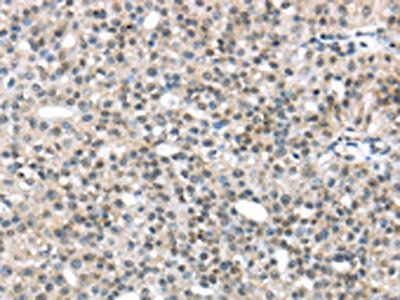 TRIP6 Antibody