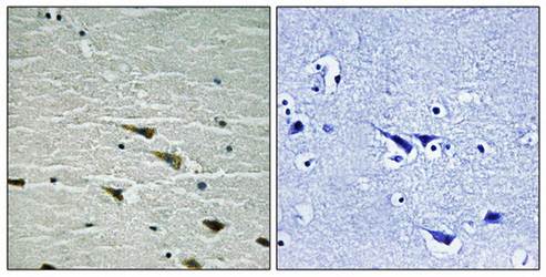 Trk A (Phospho-Tyr757) Antibody