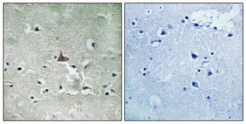 Trk B (Phospho-Tyr706+Tyr707) Antibody