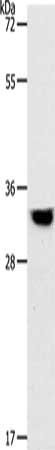 TPM2 Antibody