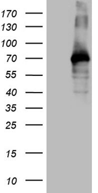 Troponin I fast skeletal muscle Antibody