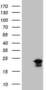 Troponin I fast skeletal muscle Antibody