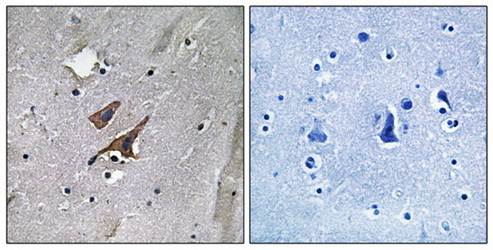 TSC2 (Phospho-Tyr1571) Antibody