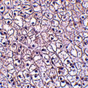 TSLP Receptor Antibody