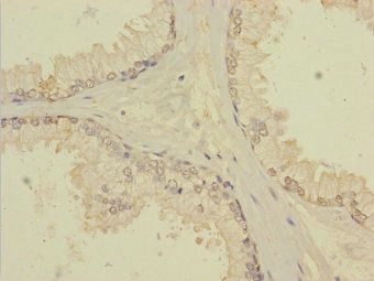 TTC12 Antibody