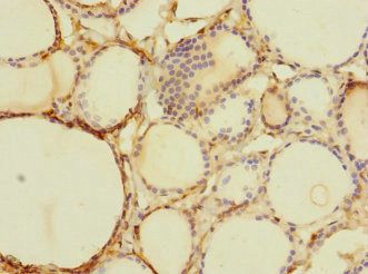 TTC12 Antibody
