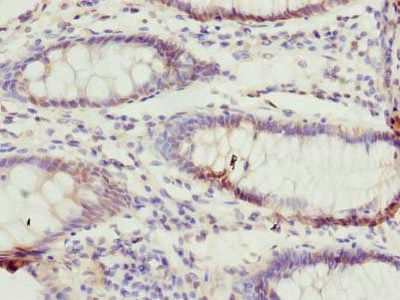 TTC38 Antibody