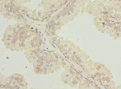 TTC38 Antibody