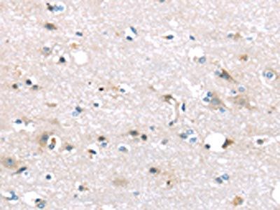 TTI1 Antibody