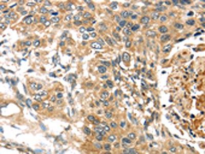 TTI1 Antibody