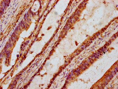 TTI2 Antibody