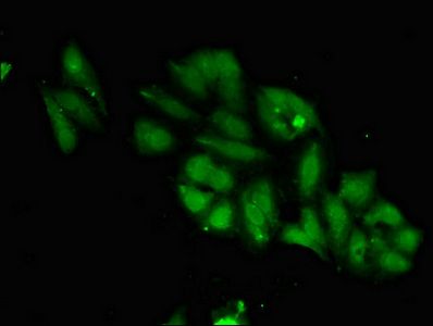TTK Antibody