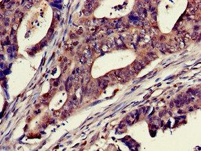 TTK Antibody