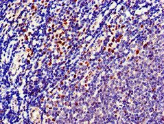 TTK Antibody