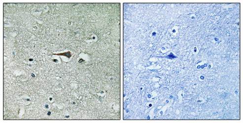 TTK (Ab-676) Antibody