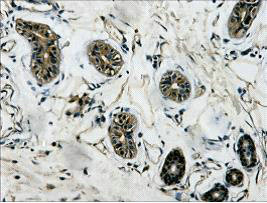 TUBB3 Monoclonal Antibody
