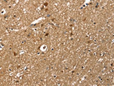 TWF1 Antibody