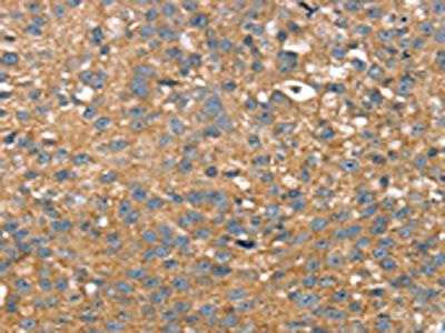 TWF1 Antibody