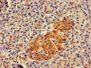 TWF1 Antibody