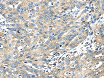 TXNDC5 Antibody