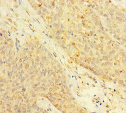 TYMP Antibody