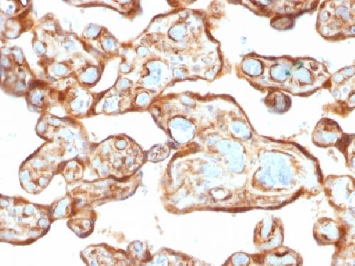 Thymidine Phosphorylase / PD-ECGF (Angiogenesis Marker) Antibody