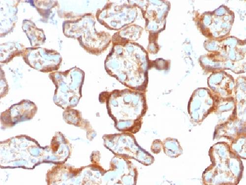 Thymidine Phosphorylase / PD-ECGF (Angiogenesis Marker) Antibody