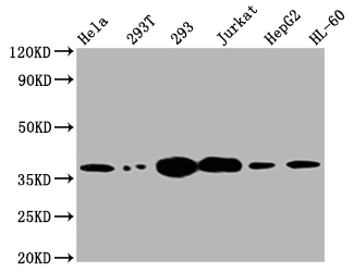 TYMS Recombinant Monoclonal Antibody