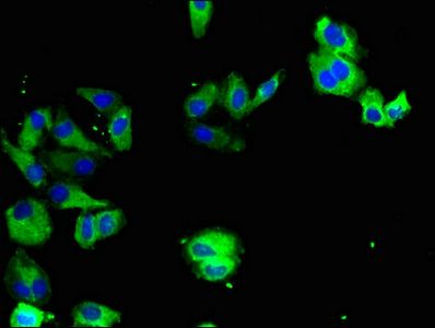 TYRO3 Antibody