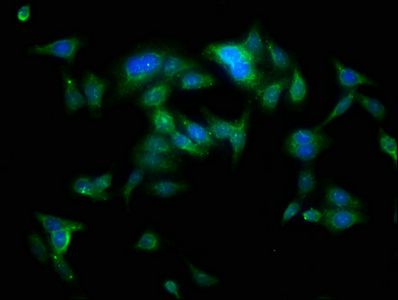 YARS Antibody